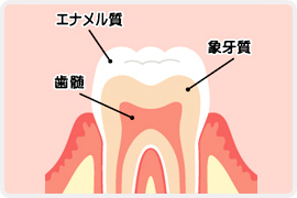虫歯治療