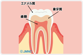虫歯