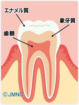 虫歯
