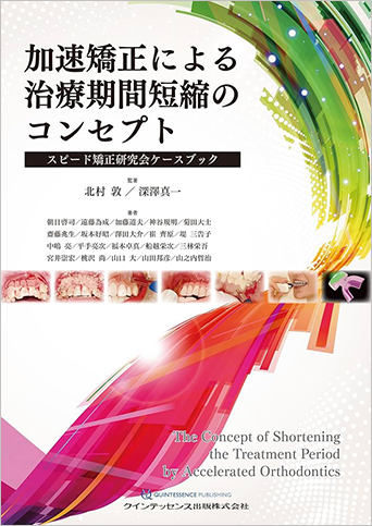 加速矯正による治療期間短縮のコンセプト