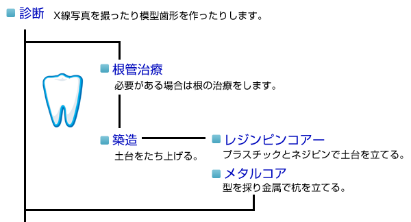 補綴ができるまで