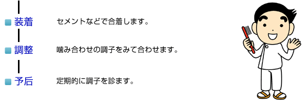 補綴ができるまで